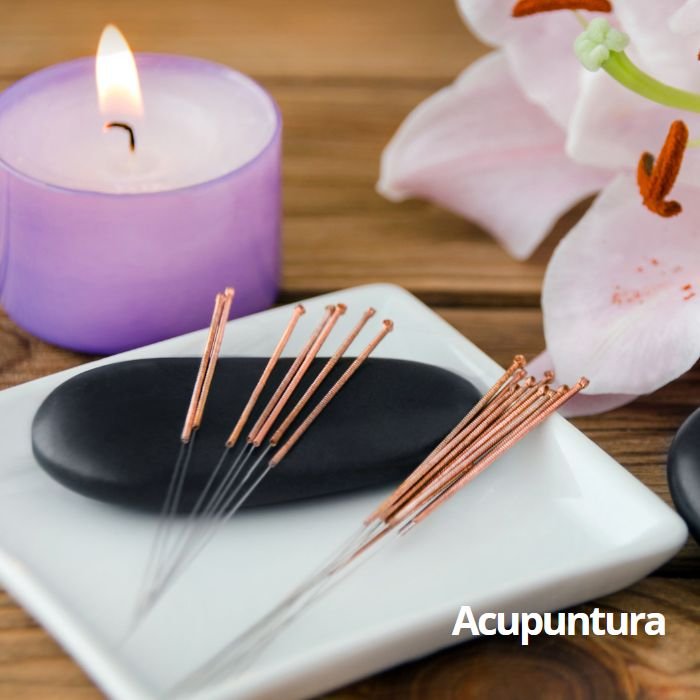Acupuntura em Hortolândia
